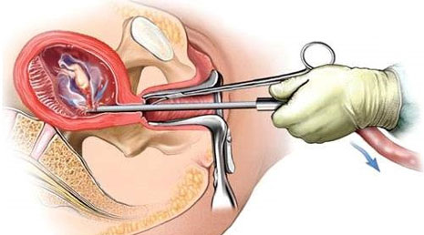 Medical Abortion Clinic Abu Dhabi